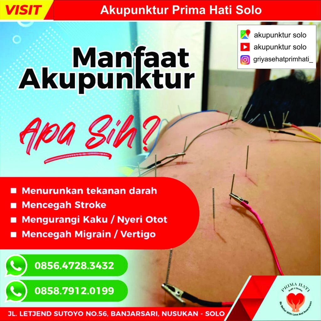 manfaat akupunktur